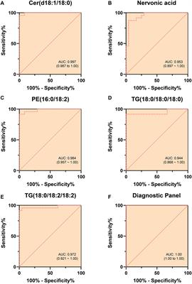 Lipid metabolic profiling and diagnostic model development for hyperlipidemic acute pancreatitis